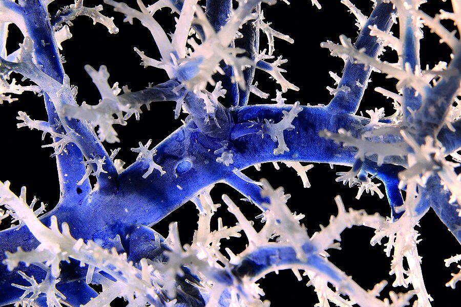 Zu sehen ist eine Nahaufnahme eines großen, blauen Blutgefäßes, das sich zunehmend feiner in weiße Adern verästelt.  Zu sehen ist eine Nahaufnahme eines großen, blauen Blutgefäßes, das sich zunehmend feiner in weiße Adern verästelt.