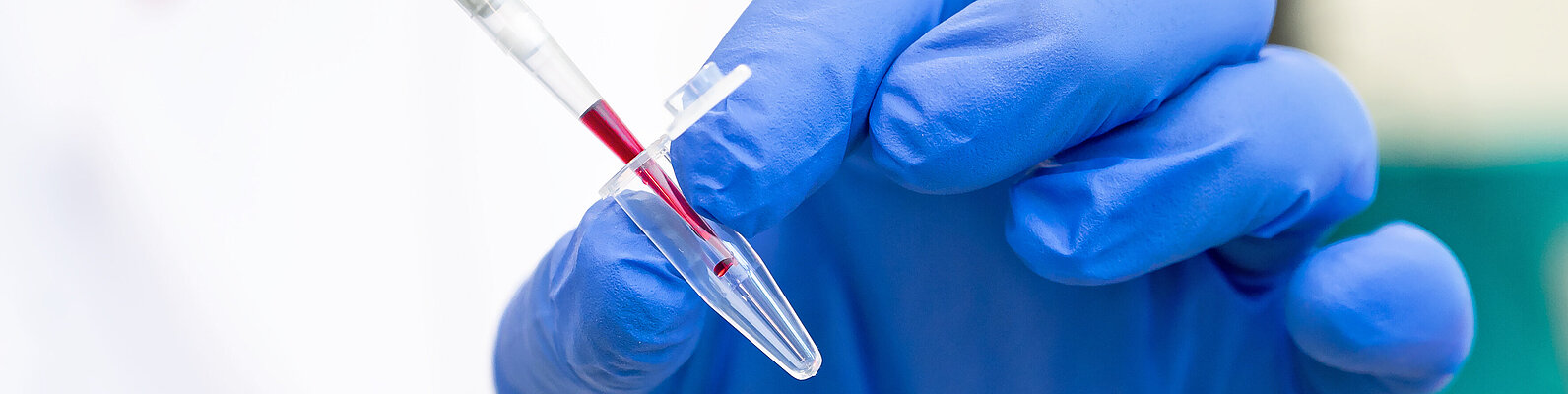 Medizinisches Personal füllt entnommene Flüssigkeit in ein Laborröhrchen