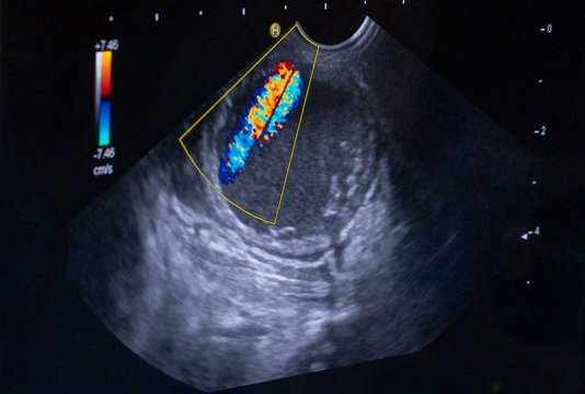 Innere Medizin I 