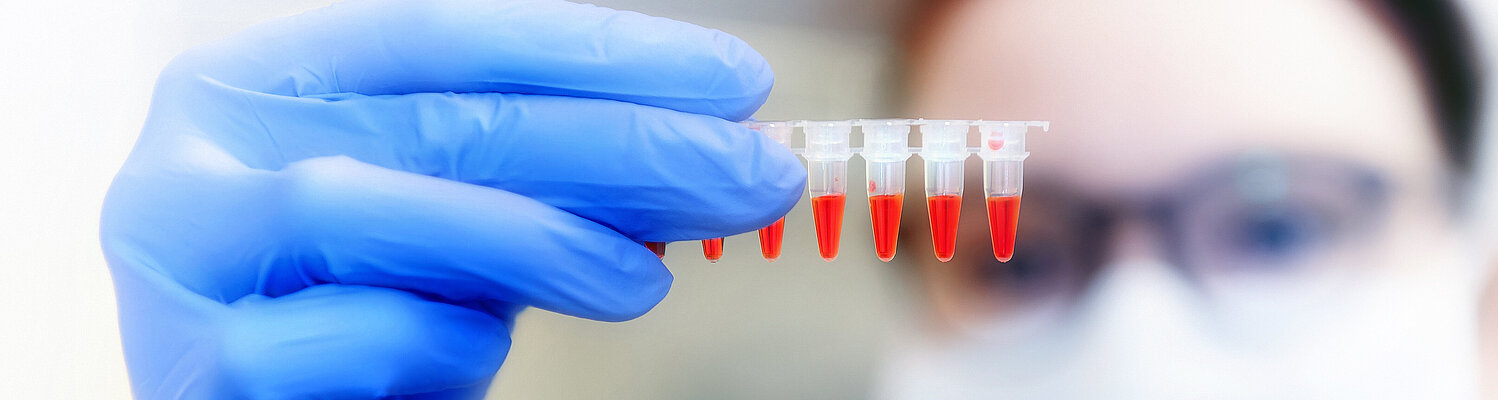 Eine Frau im weißen Kittel mit Maske und blauen Handschuhe schaut sich Proben für das Labor an