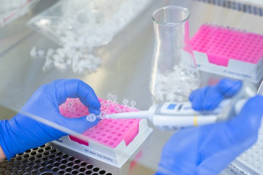 Hier finden Sie Informationen der Arbeitsgruppen:

- NWG Hämmerle
- AG Endokrine Pathologie
- AG Hämatopathologie
- AG Kopf-Hals