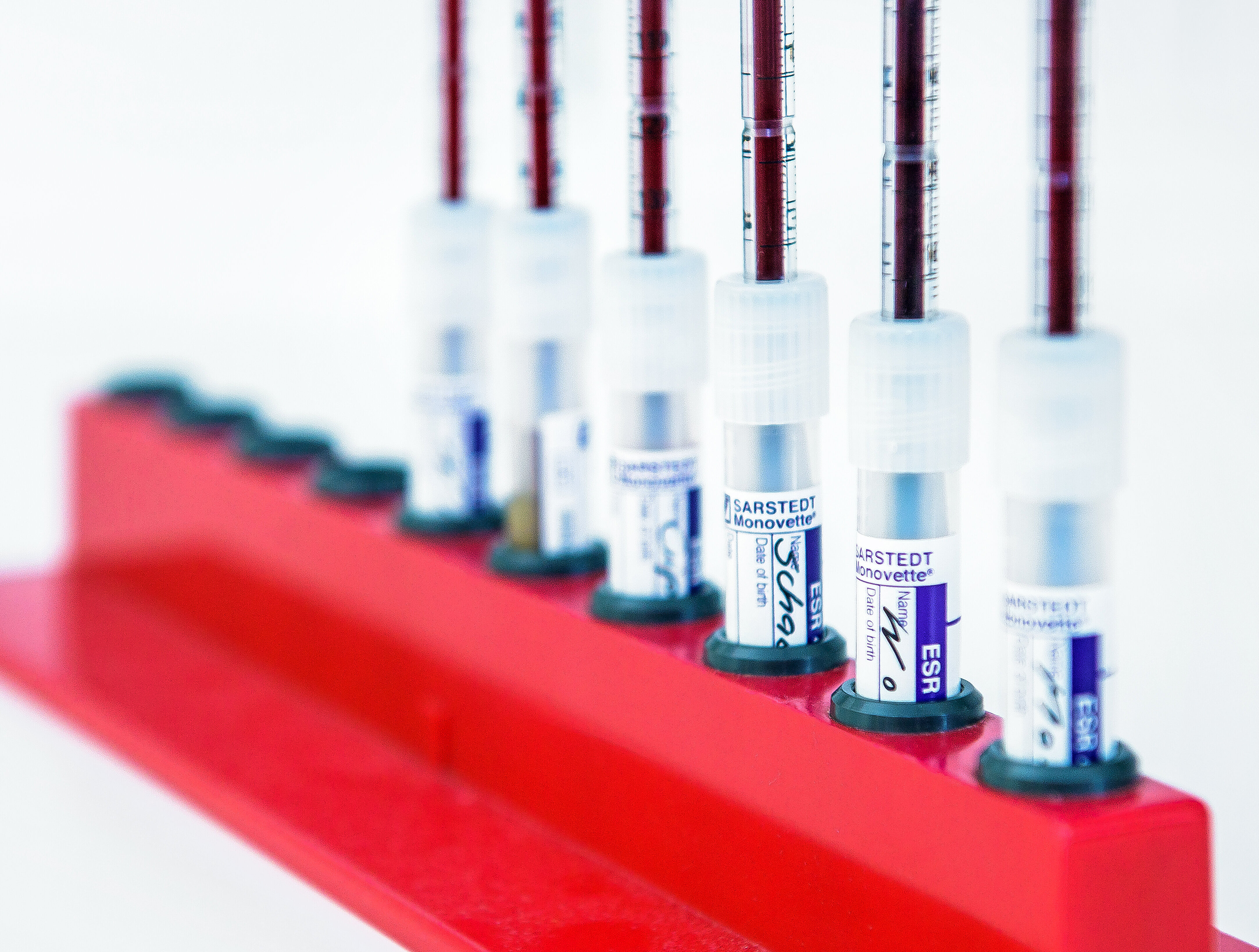 Ständer mit mehreren Gefäßen mit Blut