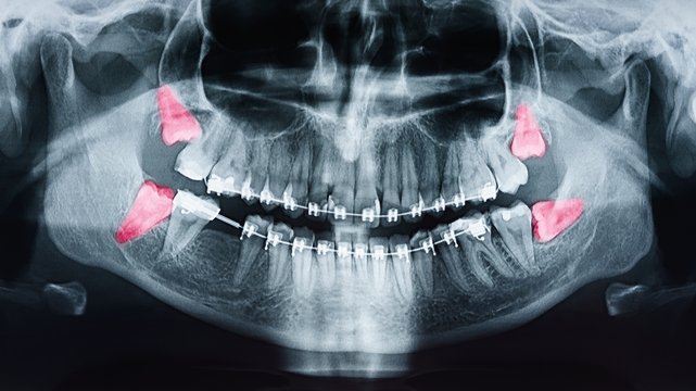 Forensische Odontostomatologie