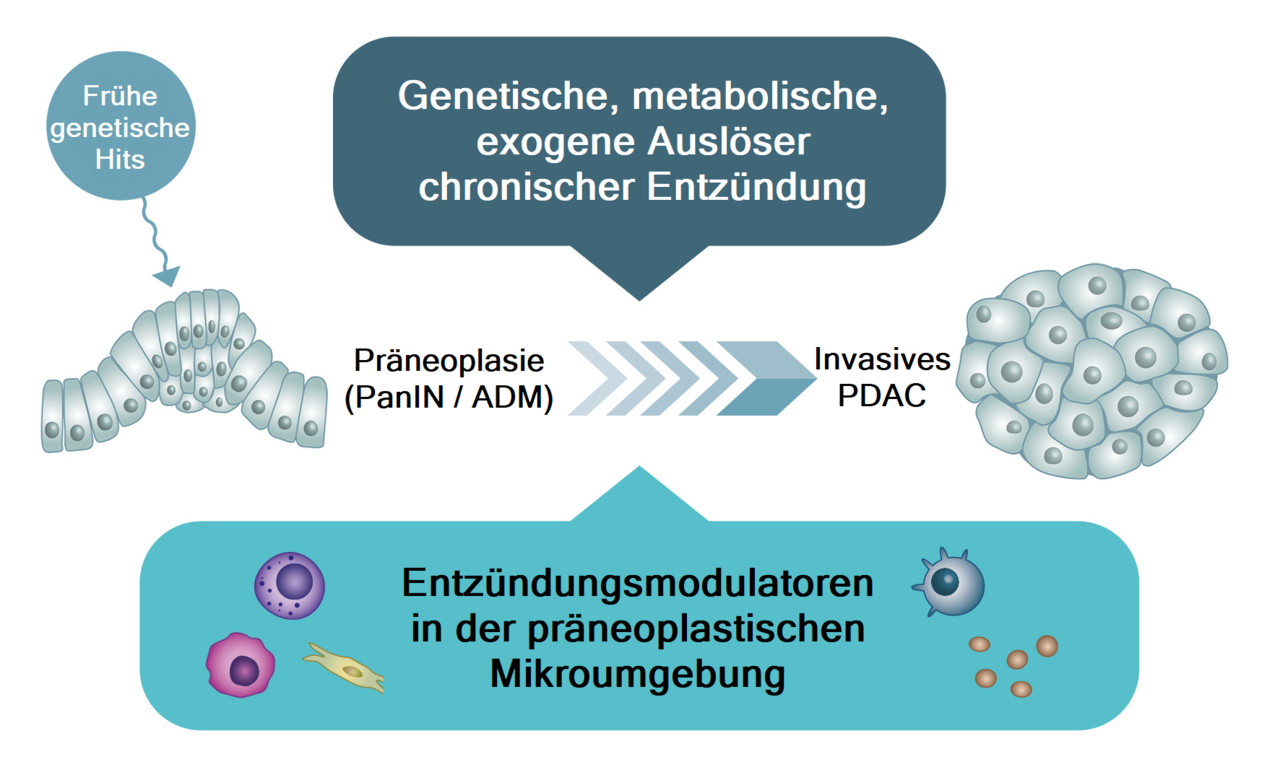 Das Bild zeigt schematisch ein unauffälliges Pankreasgewebe, aus dem durch Einwirkung von genetischen, metabolischen und exogenen Auslösern chronischer Entzündung ein invasives Pankreaskarzinom hervorgeht. Der Übergang von Präneoplasie zu invasivem PDAC wird dabei durch Entzündungsmodulatoren beeinflusst.