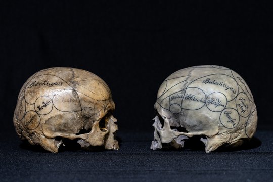 3D-Scan